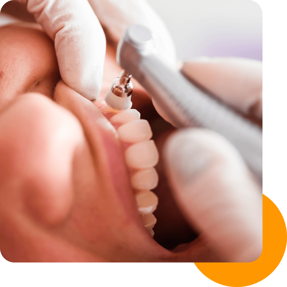 limpieza dental