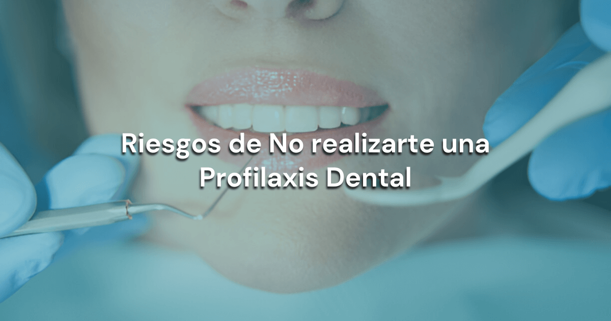 En este momento estás viendo Riesgos de No realizarte una Profilaxis Dental