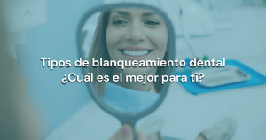 Lee más sobre el artículo Tipos de blanqueamiento dental: ¿Cuál es el mejor para ti?