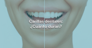 Lee más sobre el artículo Carillas dentales: ¿Cuánto duran?