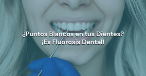 Lee más sobre el artículo ¿Puntos Blancos en tus Dientes? ¡Es Fluorosis Dental!