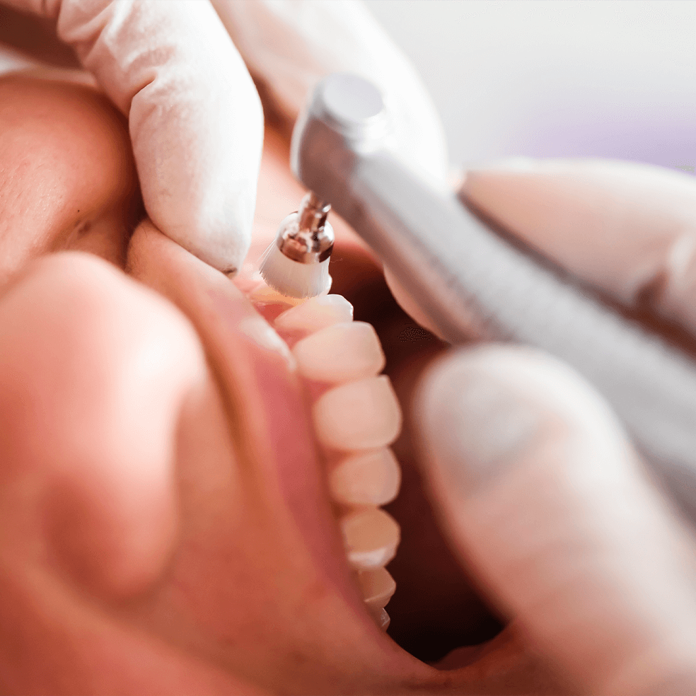 Señora mayor sonriendo después de recibir implantes dentales en Odontofas