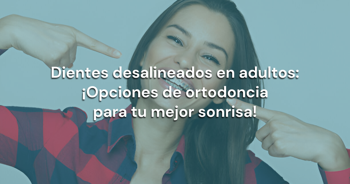 En este momento estás viendo Dientes desalineados en adultos: ¡Opciones de ortodoncia para tu mejor sonrisa!