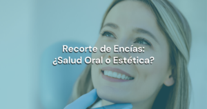 Lee más sobre el artículo Recorte de Encías: ¿Salud Oral o Estética?