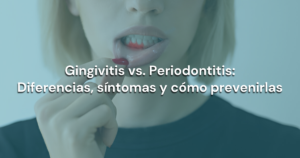 Lee más sobre el artículo Gingivitis vs. Periodontitis: Diferencias, síntomas y cómo prevenirlas