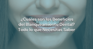Lee más sobre el artículo ¿Cuáles son los Beneficios del Blanqueamiento Dental? Todo lo que Necesitas Saber