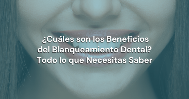 Lee más sobre el artículo ¿Cuáles son los Beneficios del Blanqueamiento Dental? Todo lo que Necesitas Saber