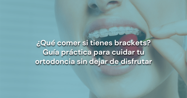 Lee más sobre el artículo ¿Qué comer si tienes brackets? Guía práctica para cuidar tu ortodoncia sin dejar de disfrutar