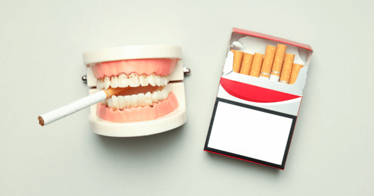 Lee más sobre el artículo ¿Se puede fumar con implantes dentales?